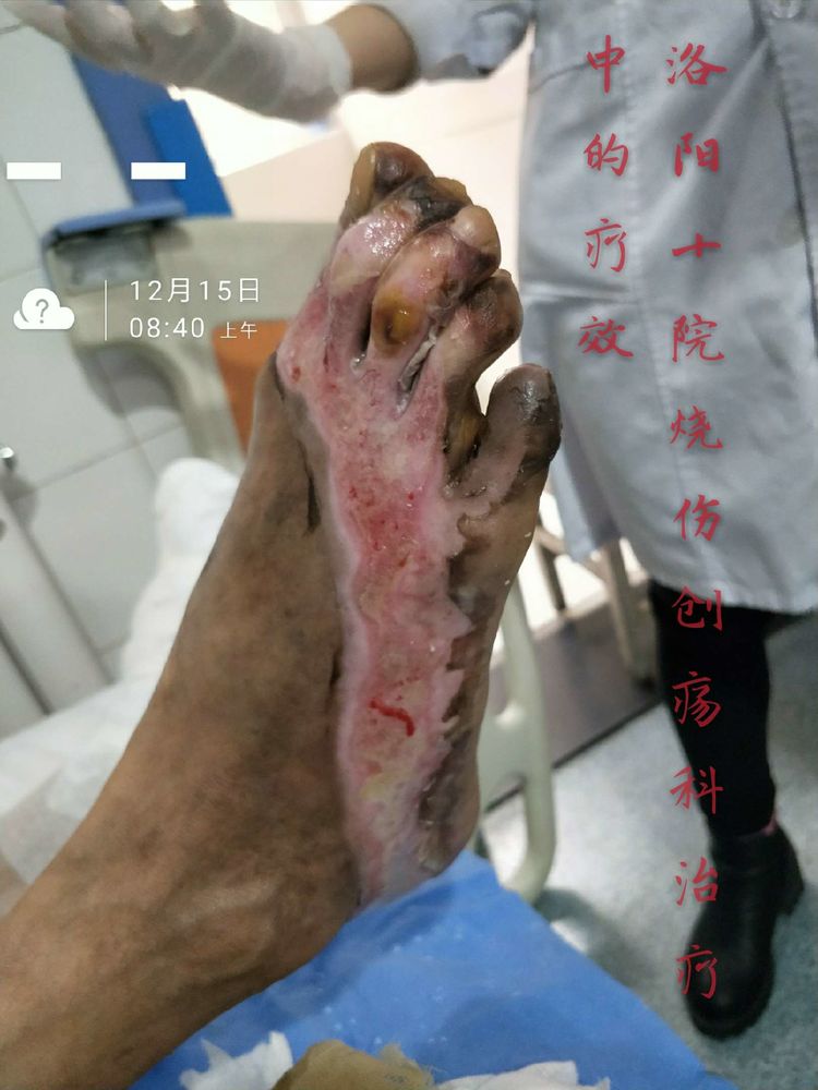 ����˹����ᡤ(�й�)����