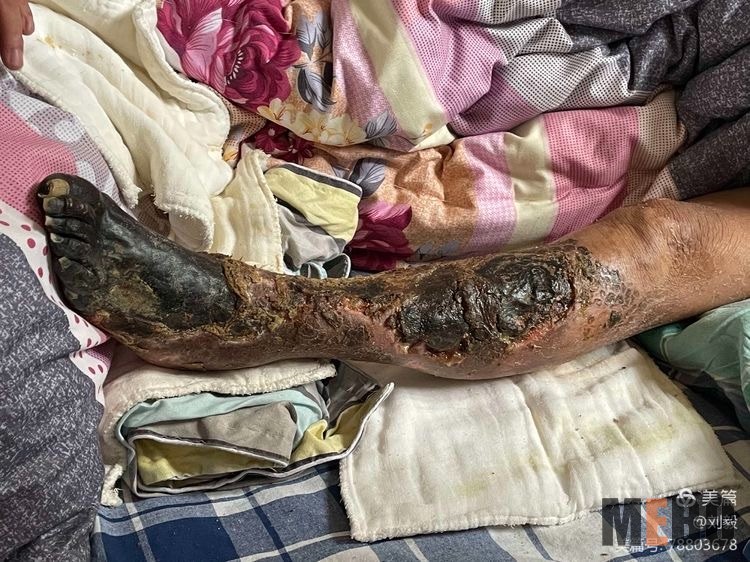 ����˹����ᡤ(�й�)����