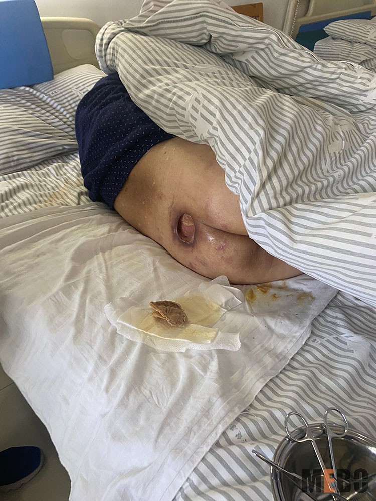 ����˹����ᡤ(�й�)����