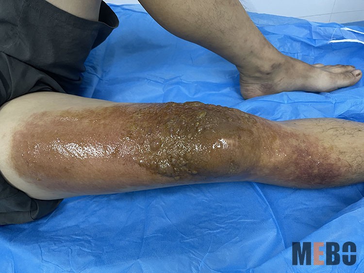 ����˹����ᡤ(�й�)����