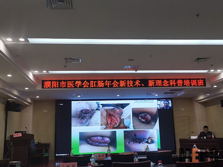 ����˹����ᡤ(�й�)����