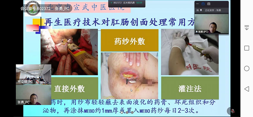 ����˹����ᡤ(�й�)����