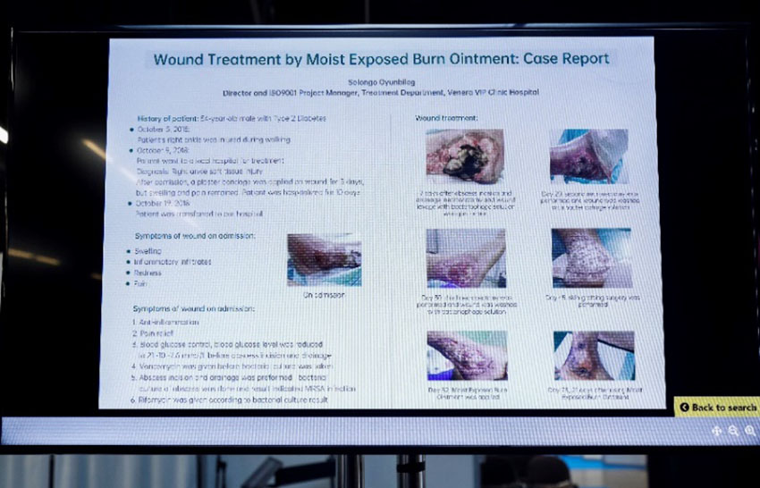 ����˹����ᡤ(�й�)����