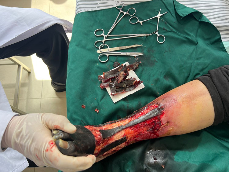 ����˹����ᡤ(�й�)����