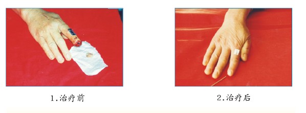 ����˹����ᡤ(�й�)����