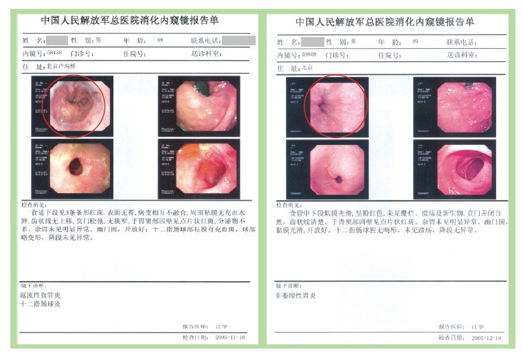 ����˹����ᡤ(�й�)����