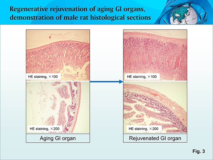 ����˹����ᡤ(�й�)����