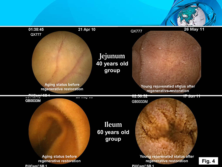 ����˹����ᡤ(�й�)����