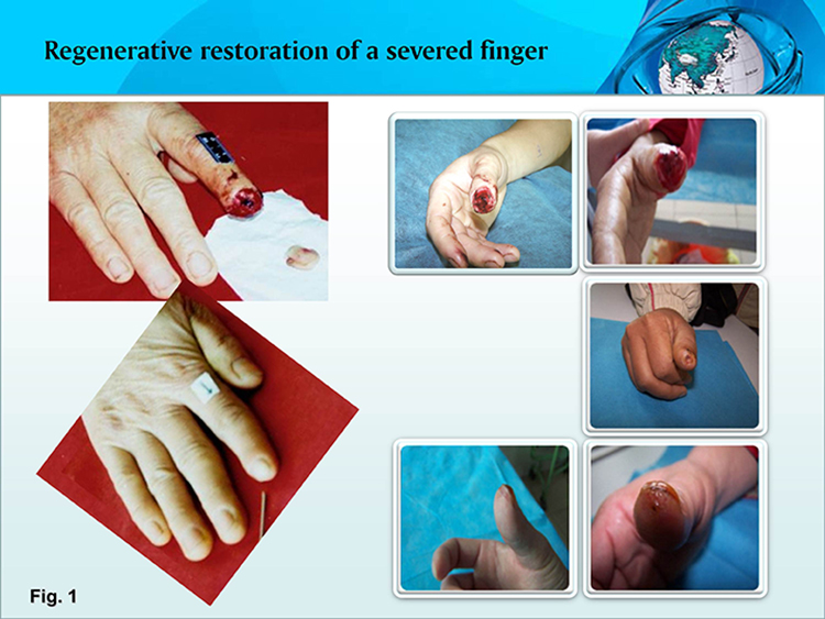 ����˹����ᡤ(�й�)����