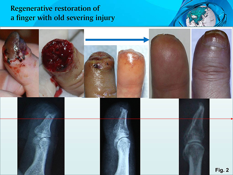 ����˹����ᡤ(�й�)����