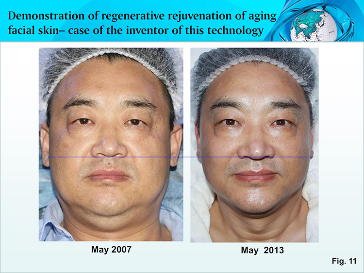 ����˹����ᡤ(�й�)����