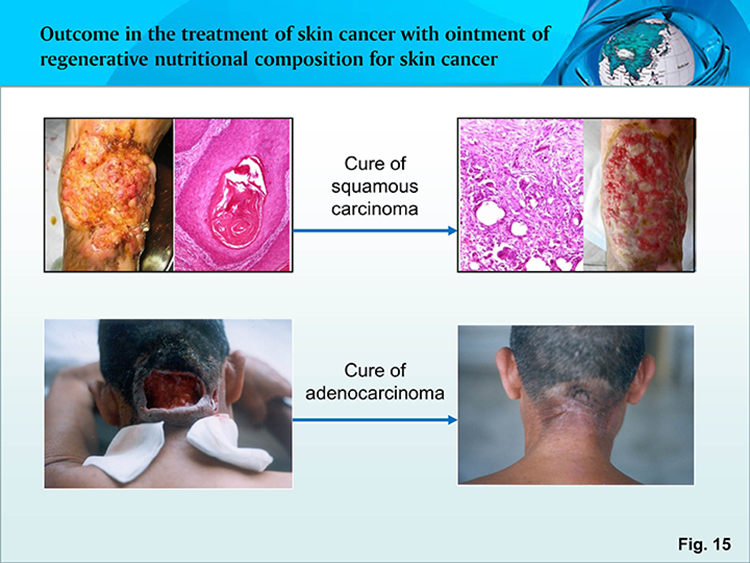 ����˹����ᡤ(�й�)����