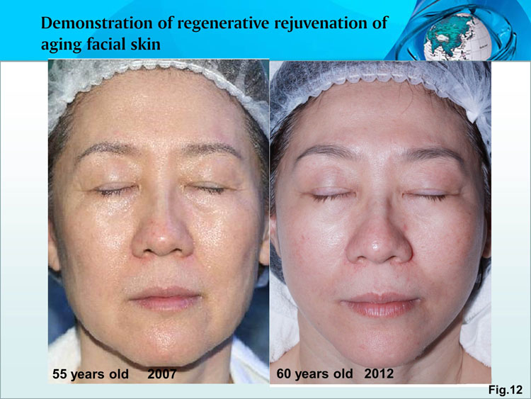 ����˹����ᡤ(�й�)����